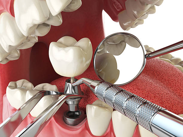 Best Broken or Cracked Tooth Emergency Dentist in Savannah, TN